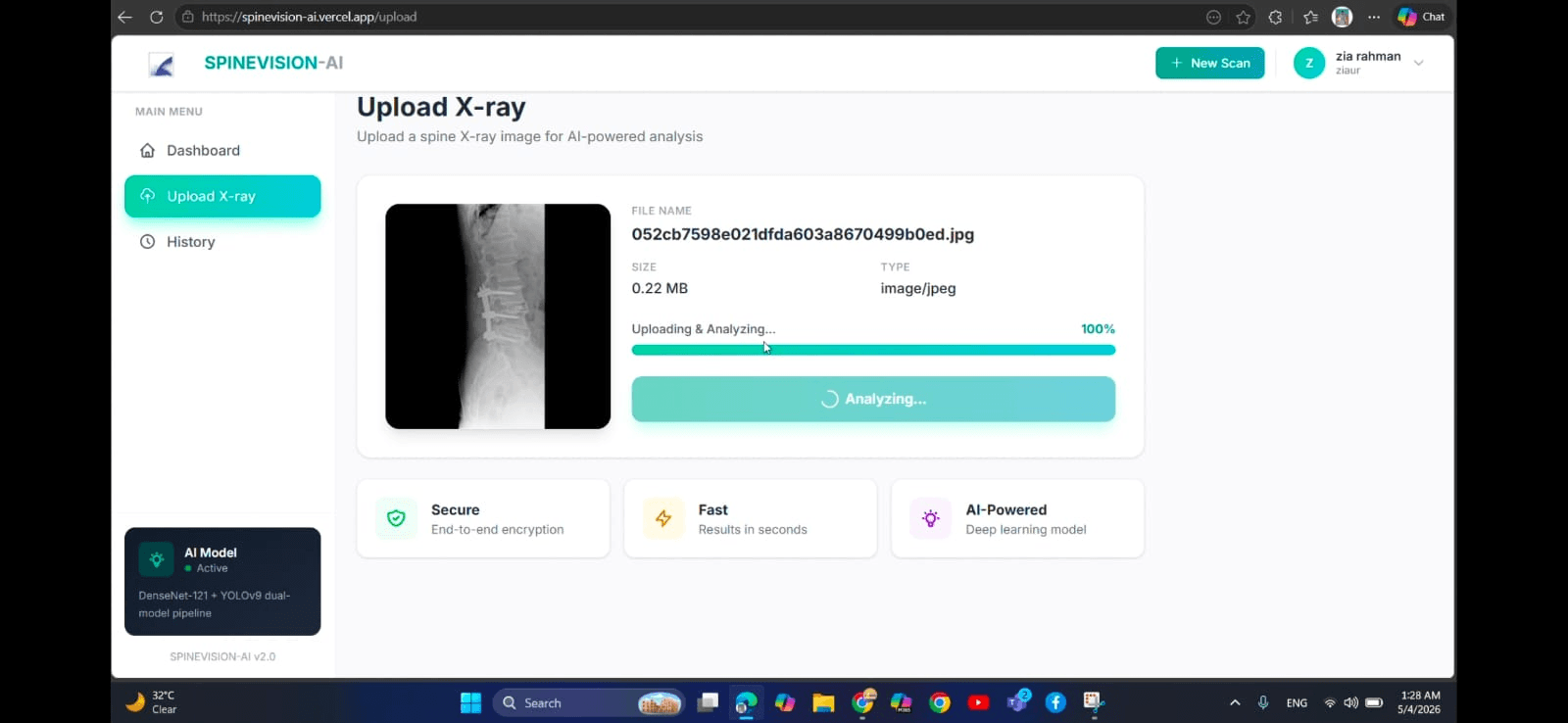 SpineVision AI - Spine Disease Detection from X-Ray screenshot 6