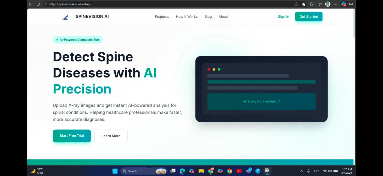 SpineVision AI - Spine Disease Detection from X-Ray